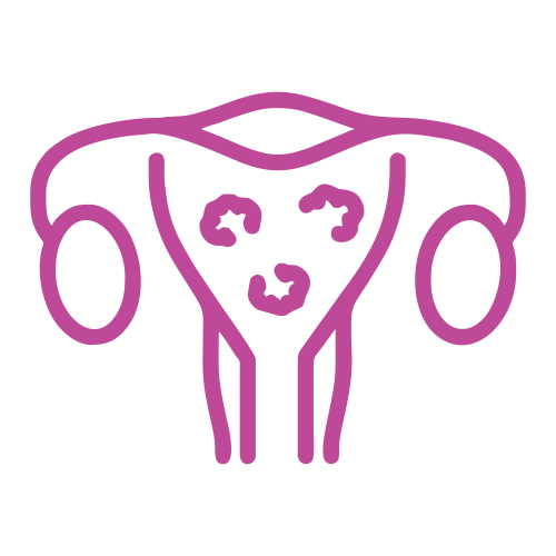 Fibroid image